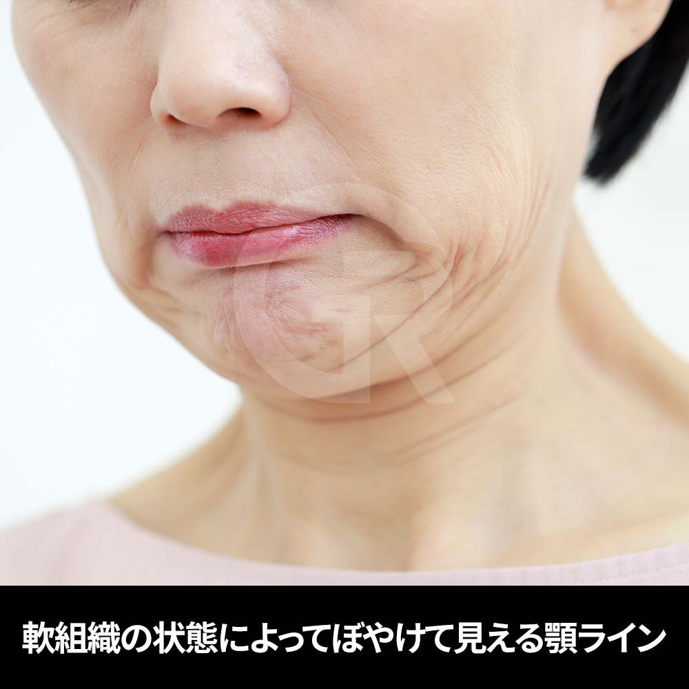 脂肪と筋肉層を含む二重顎の構造分析