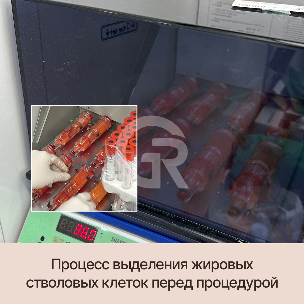Выпадение волос не происходит внезапно — оно развивается постепенноИстончение волос — это не только возраст, но и изменение структуры кожи головы