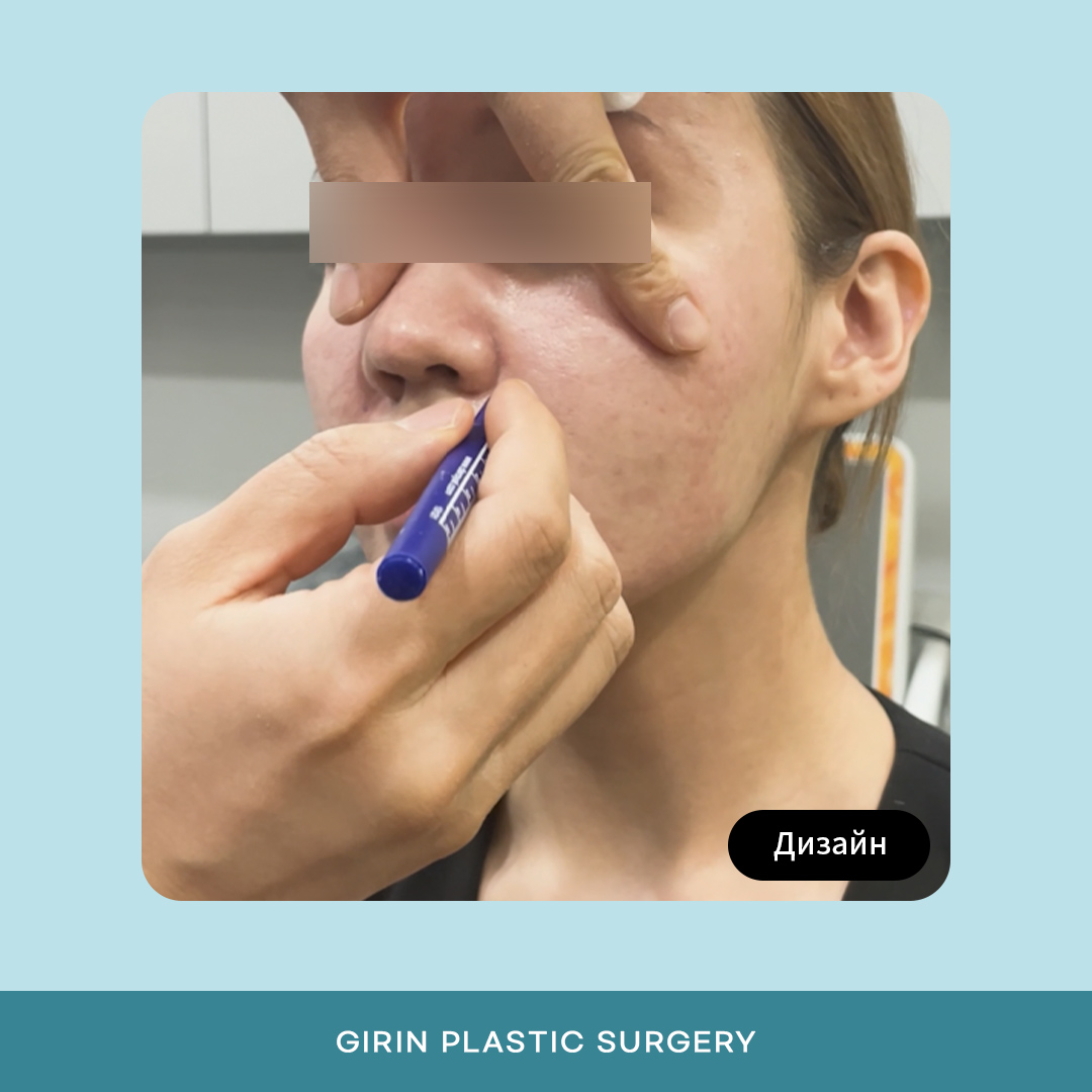 Girin Plastic Surgery — сертифицированная клиника в Сеуле с опытом работы с иностранными пациентами.