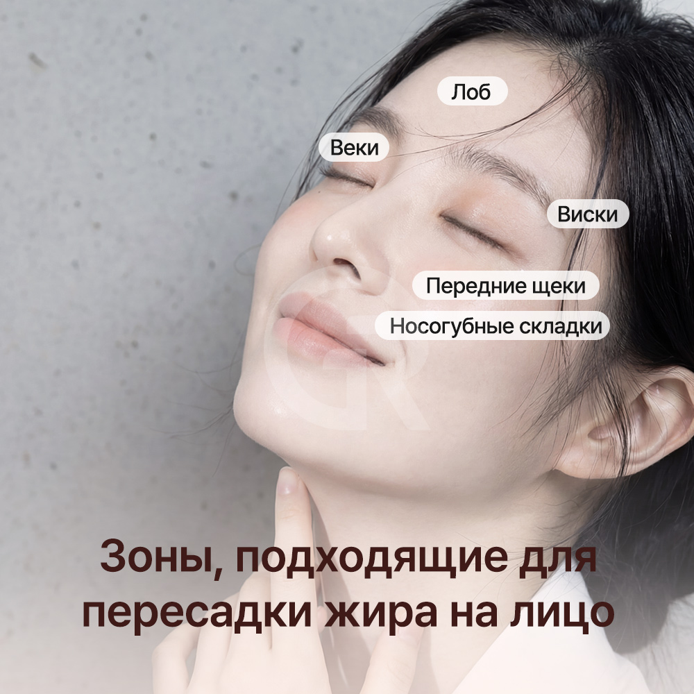 Цель микролипофилинга — восстановить естественный объем и создать мягкий, гармоничный контур лица.