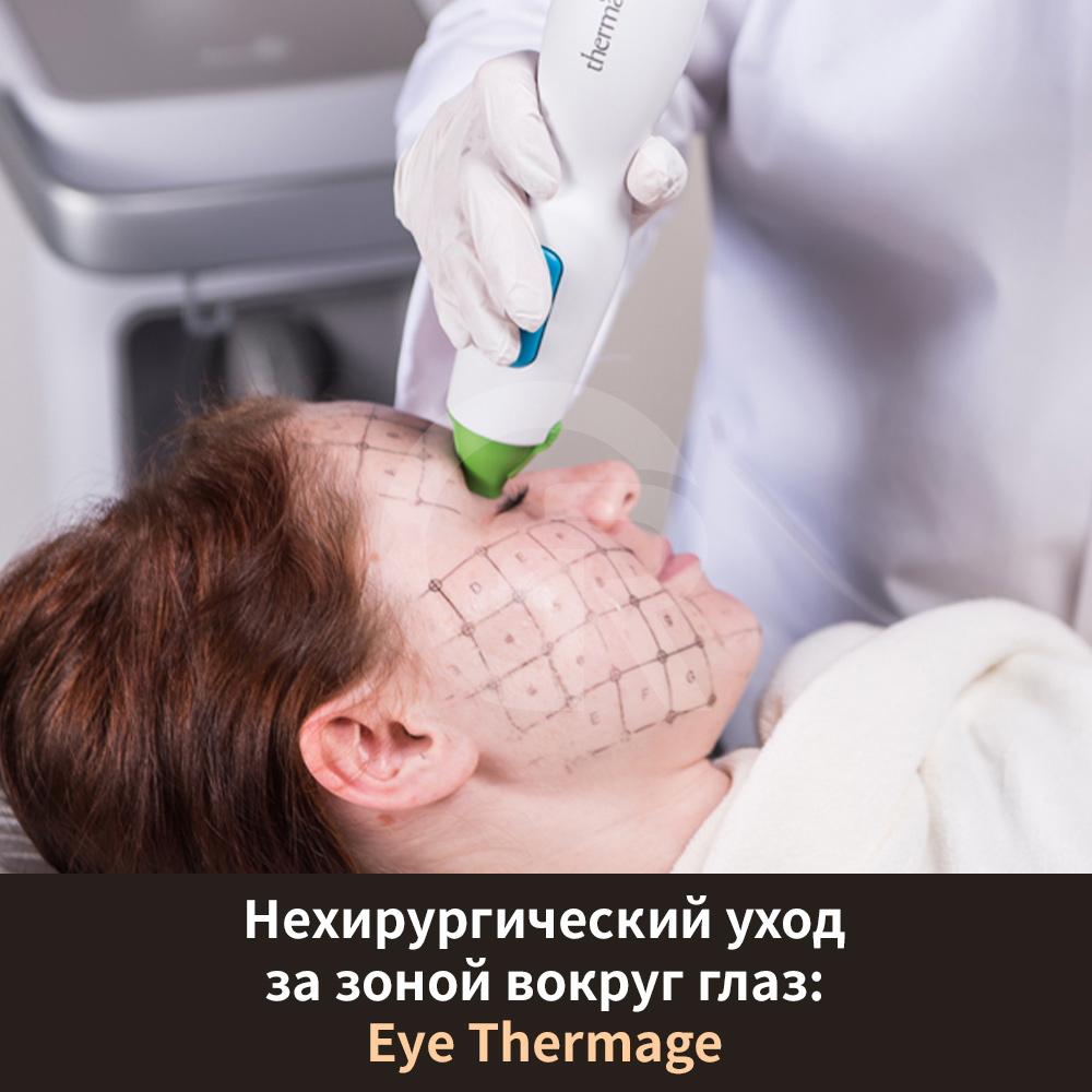 Выпячивание жировых пакетов под глазами связано с ослаблением поддерживающих структур.