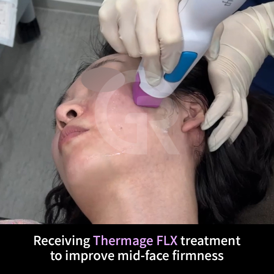 Thermage FLX is selectively used to improve elasticity in thin skin.