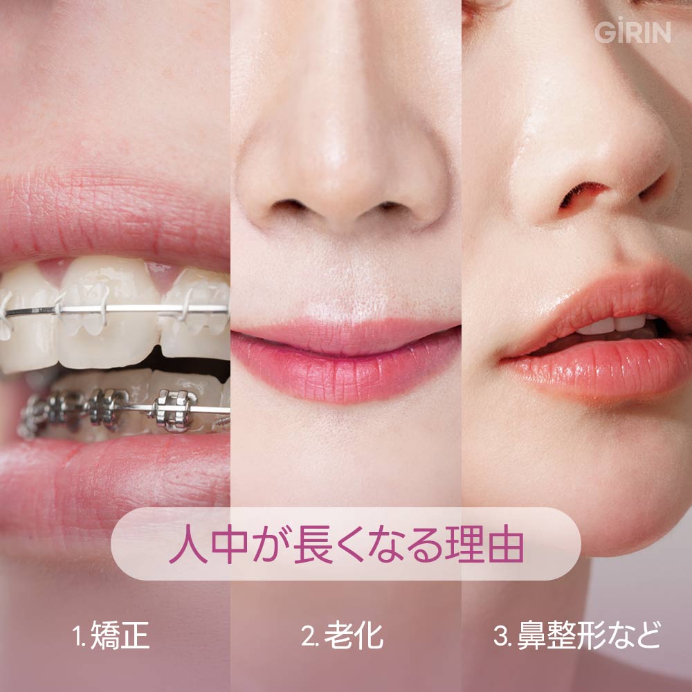 加齢による鼻下の長さの原因