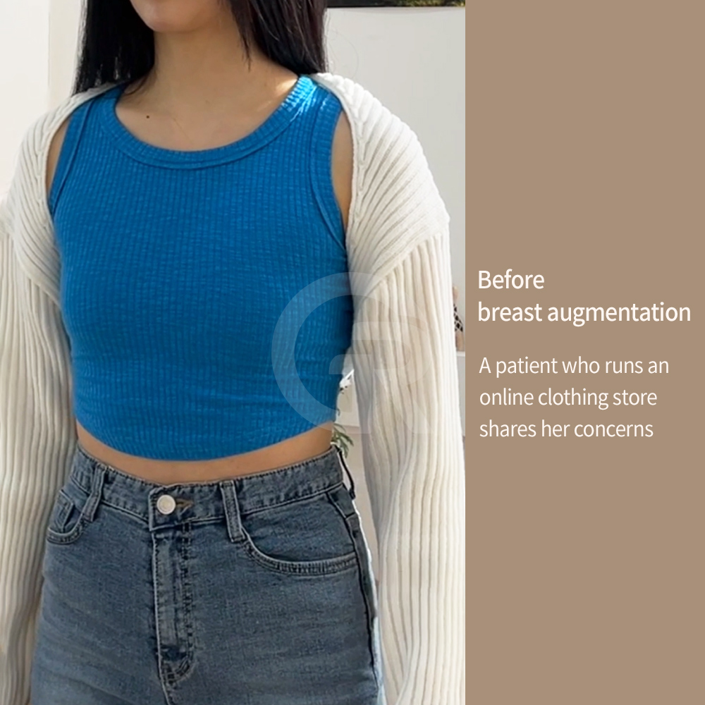 Natural breast augmentation results are achieved through careful implant selection and detailed body analysis.