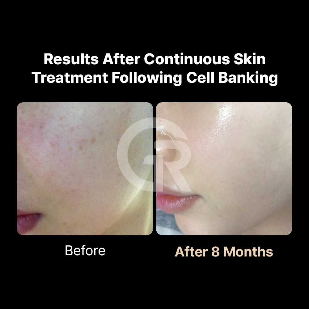 Stem cells are increasingly used in regenerative medicine for anti-aging and tissue repair.