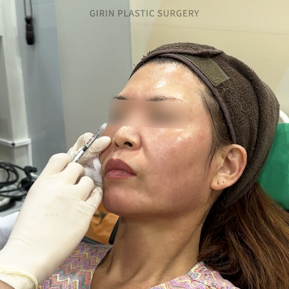 Лучшая клиника Thermage в Сеуле