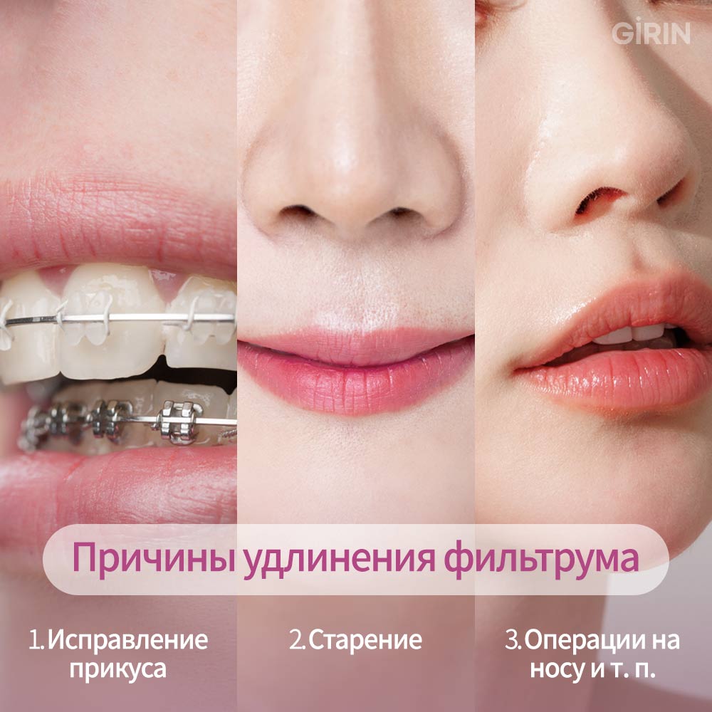 Уменьшение длины фильтрума без операции с естественным эффектом