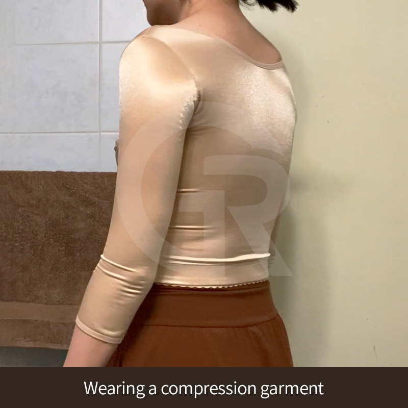 Patient experiences highlight the importance of identifying arm type before surgery.
