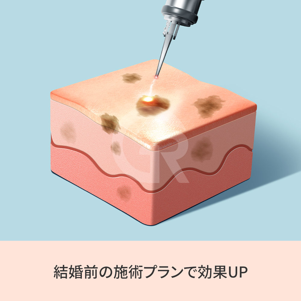 Skinvive は、肌内部の保湿環境を改善し、自然なツヤ感のある肌状態を作ります。