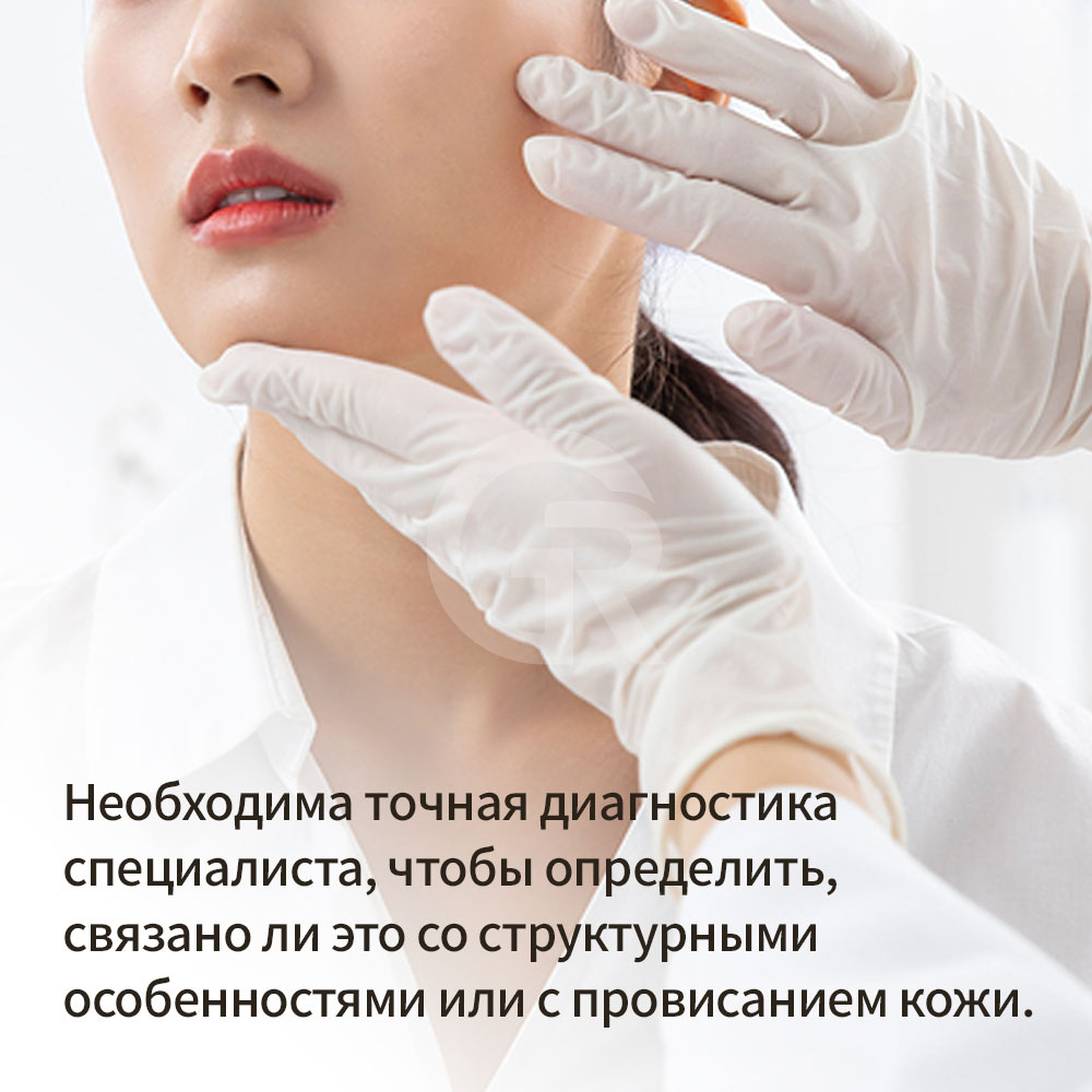 Мини-фейслифтинг в клинике Гирин в Каннаме, Корея, помогает естественно улучшить провисание вокруг рта и глубокие носогубные складки.