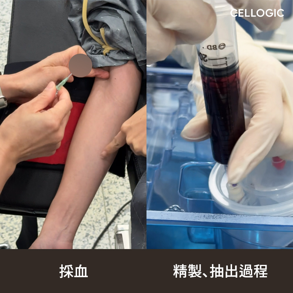 CELLTHERAはリフティングとstem cell再生治療を組み合わせ、肌構造と肌質の両方にアプローチします。