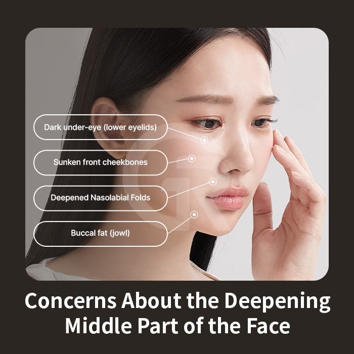 When midface descent is structural, non-surgical treatments may offer limited positional correction.