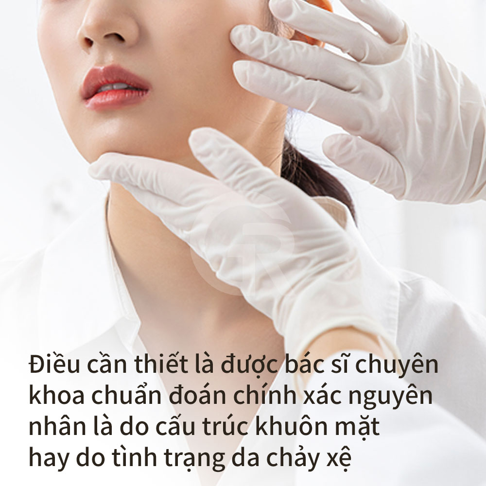 Căng da mặt mini tại Girin ở Gangnam, Hàn Quốc giúp cải thiện tình trạng chảy xệ quanh miệng và rãnh mũi má sâu một cách tự nhiên.