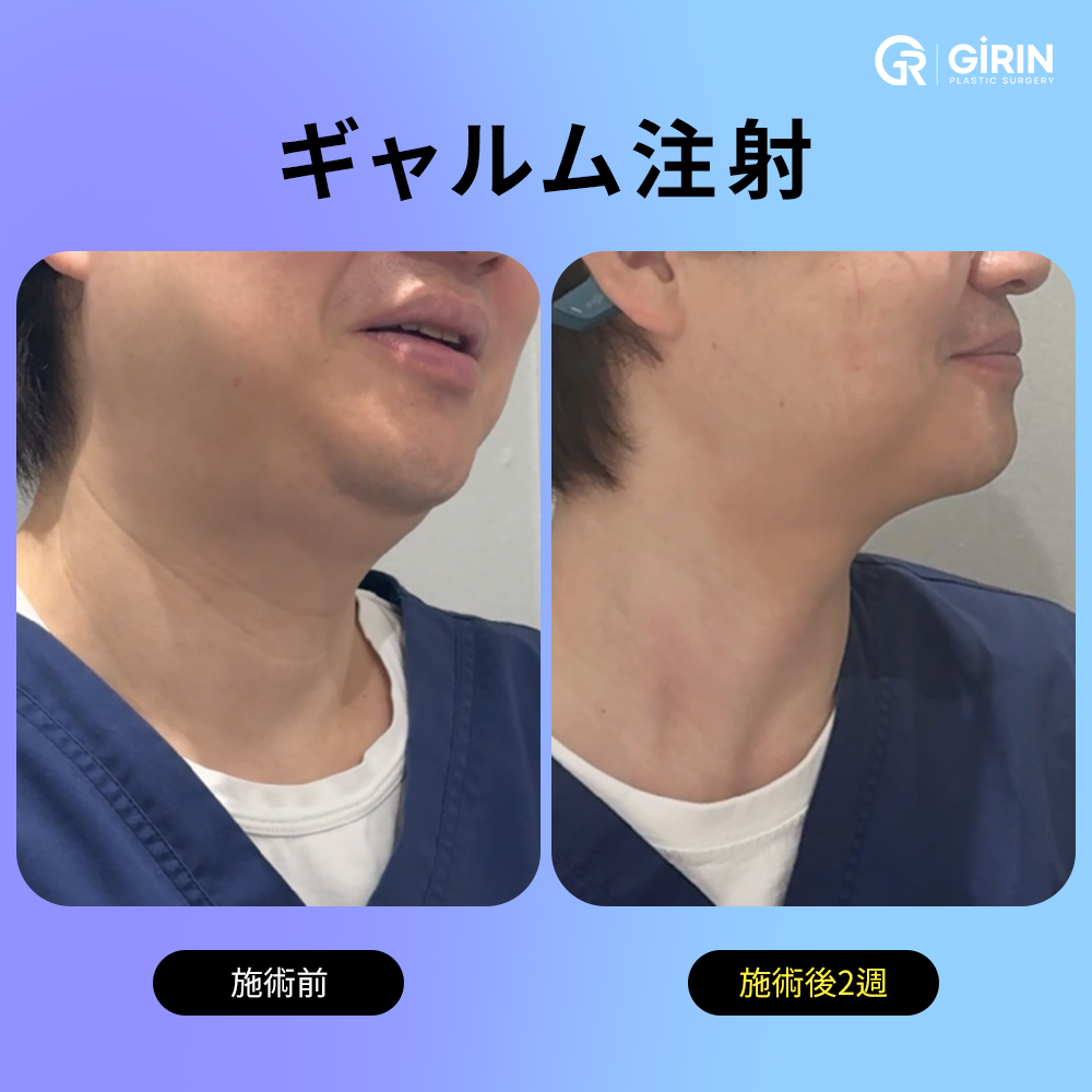 2週間で目に見える変化