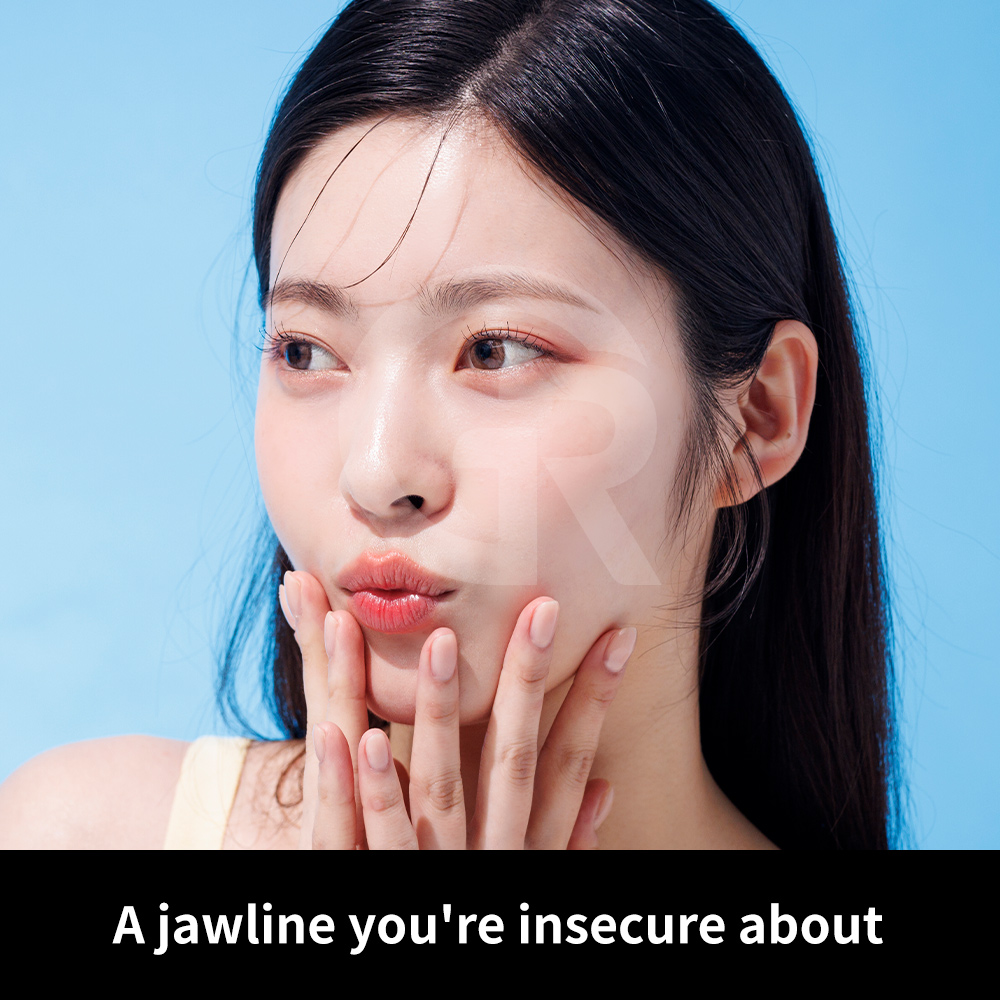 Improved jaw and neck angle after structural soft tissue correction