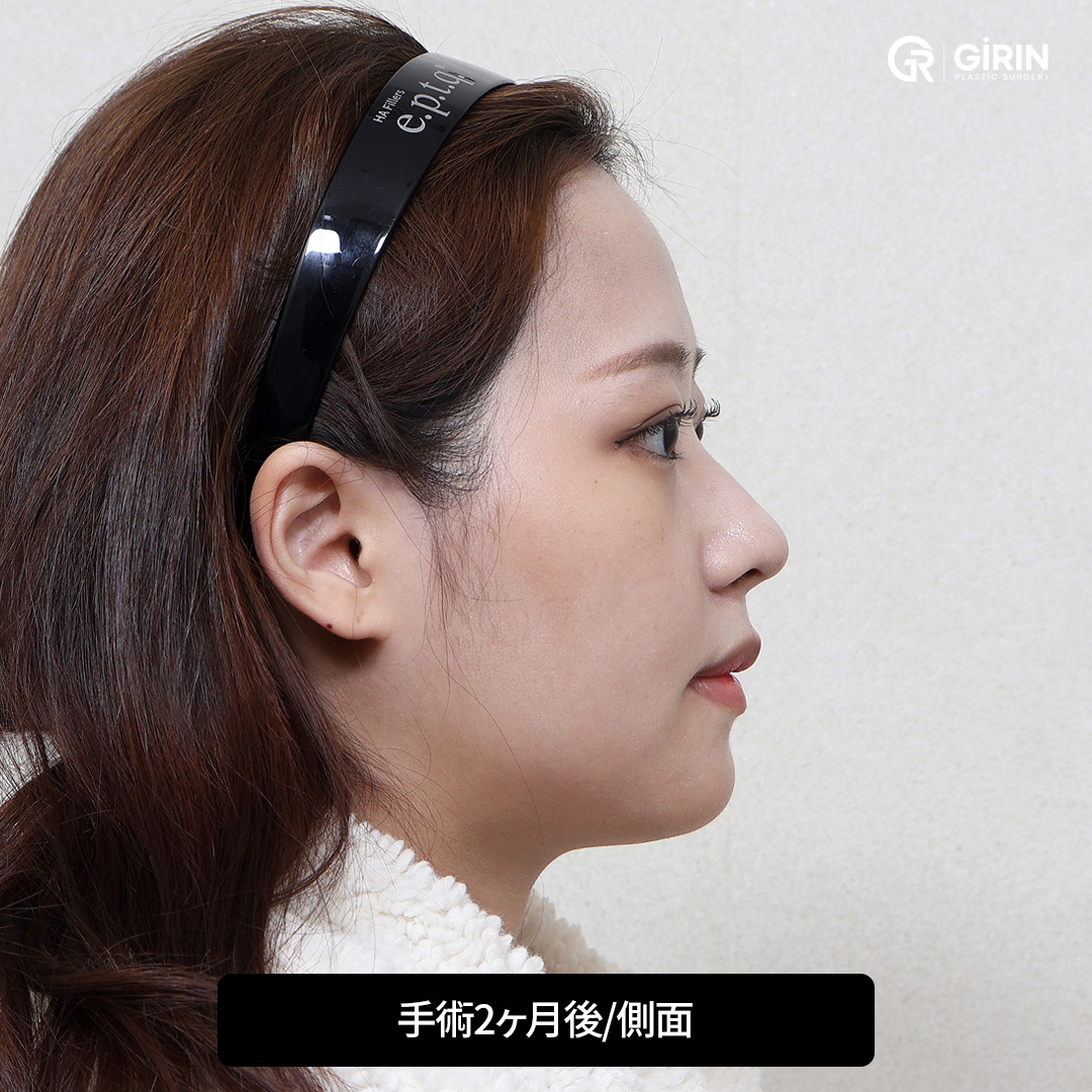 韓国SSROによる自然で美しい変化
