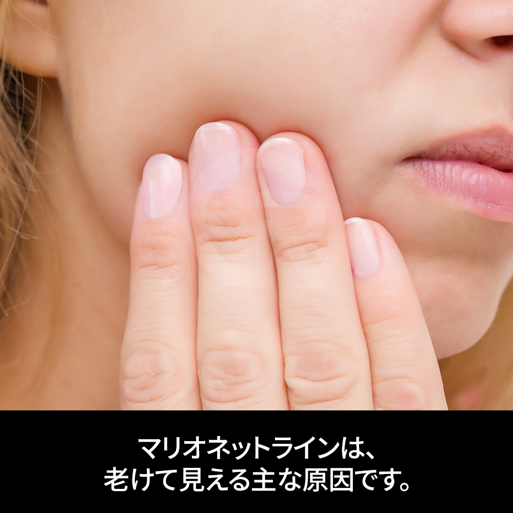 骨手術なしで顔の余白を整理するアプローチ