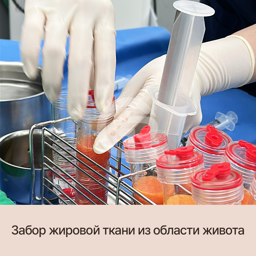 Если кажется, что волосы растут хуже, возможно, цикл роста уже нарушенВыпадение волос не происходит внезапно — оно развивается постепенно