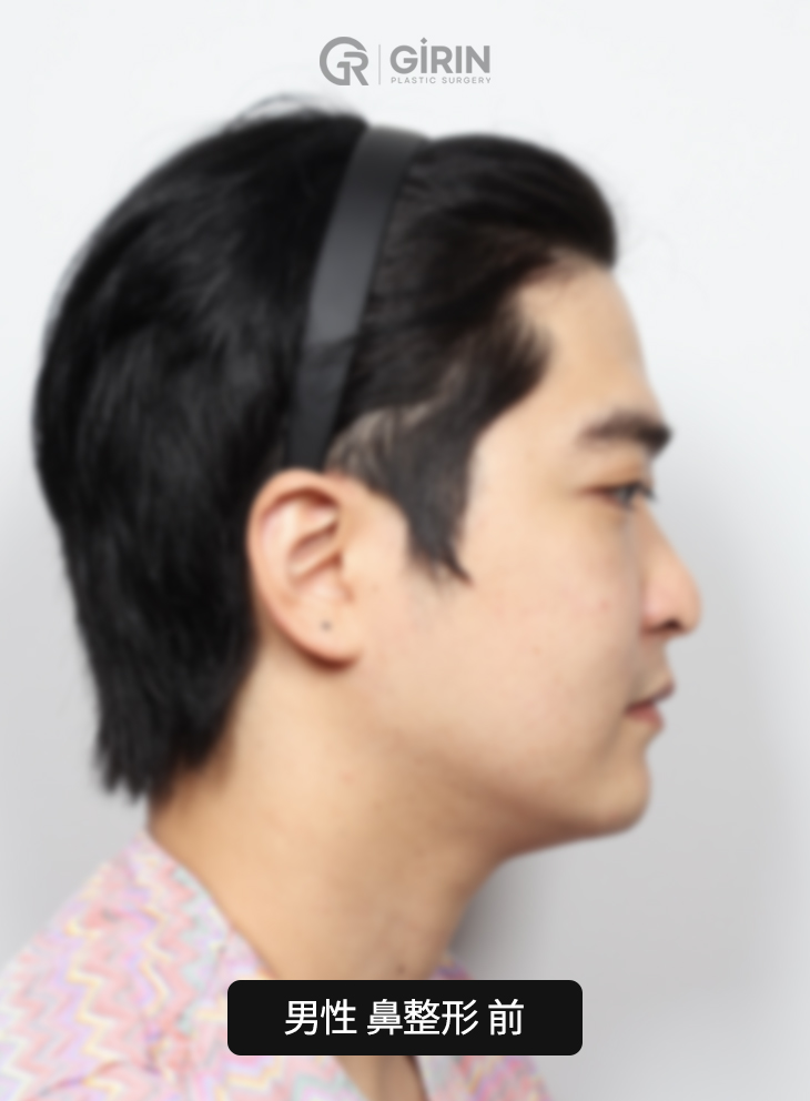 韩国知名男性鼻整形专科医院。