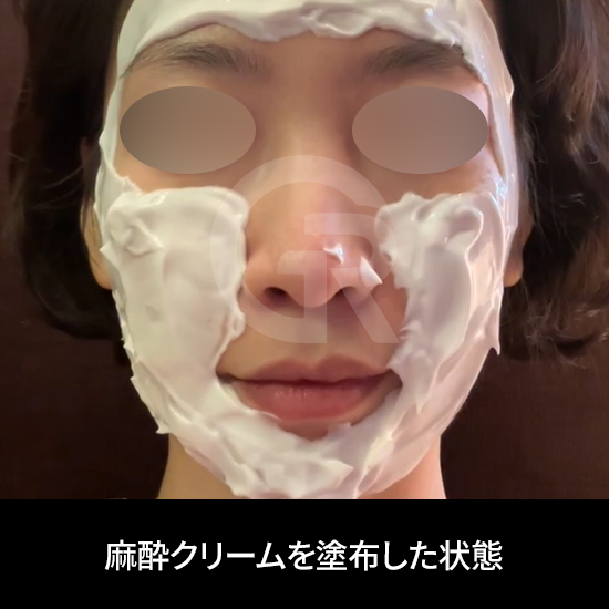 適切な治療計画のためには、肌状態の総合的な評価が欠かせません。