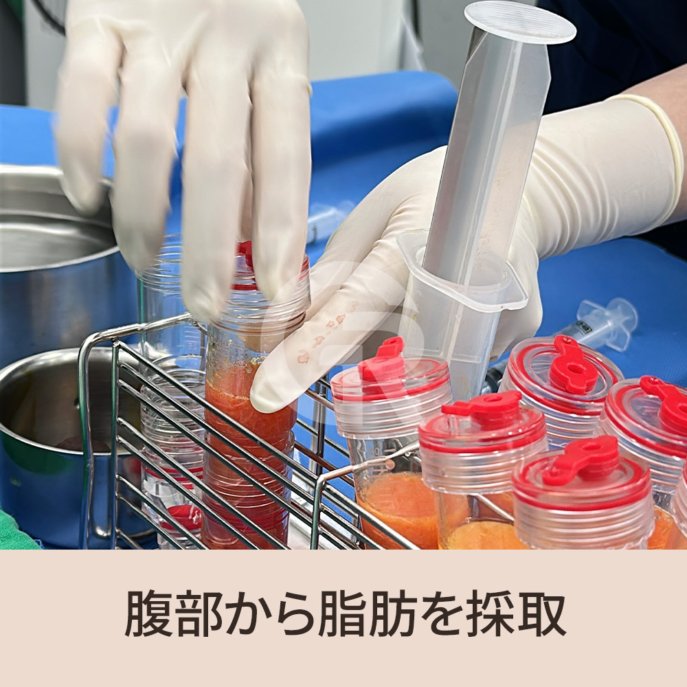 薄毛は突然起こるものではなく、時間をかけて静かに進行し、気づいたときにはすでに変化が進んでいるケースが多く見られます