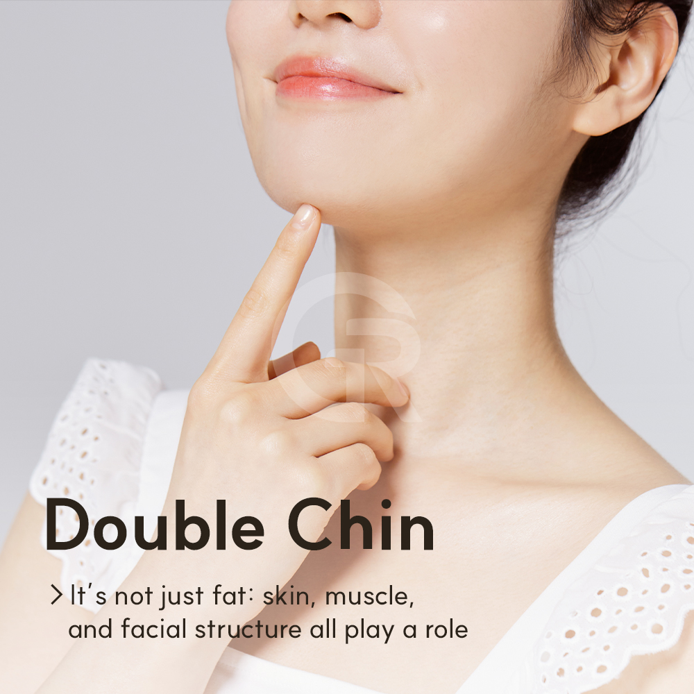 Girin Plastic Surgery in Seoul, Gangnam evaluates double chin concerns by looking at fat, skin, muscles, and overall facial balance.