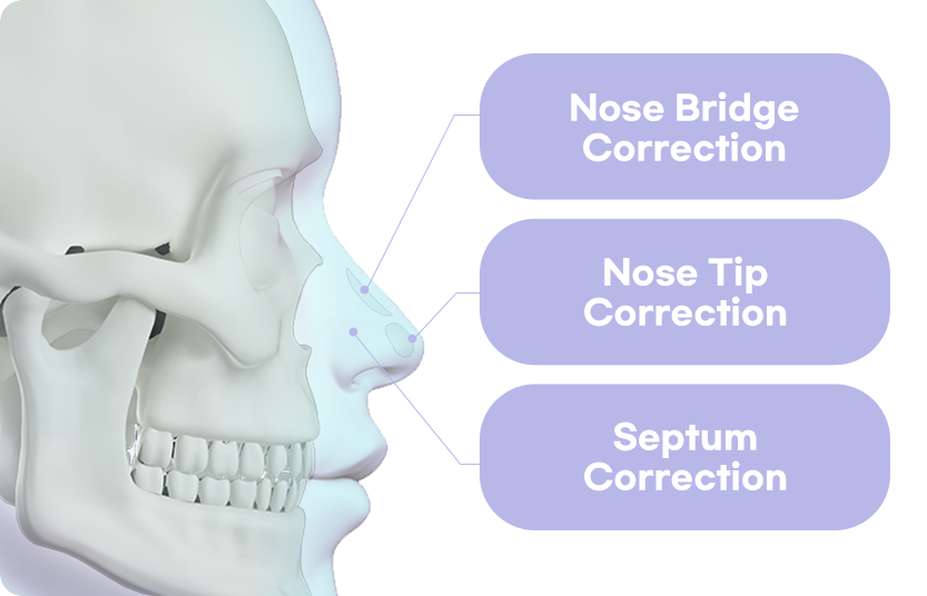 nose bridge correction, nose tip correction, septum correction