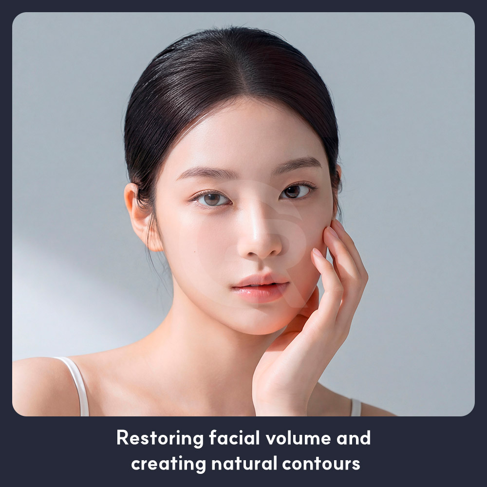 Fat grafting around the nasolabial area may help soften the visual prominence around the mouth.