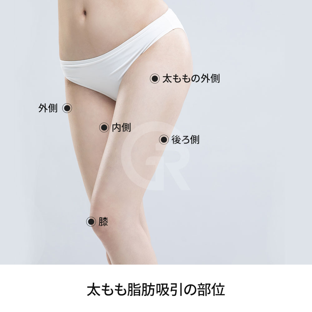 体重が標準範囲内でも、太ももに脂肪が集中すると下半身が重く見えることがあります。
