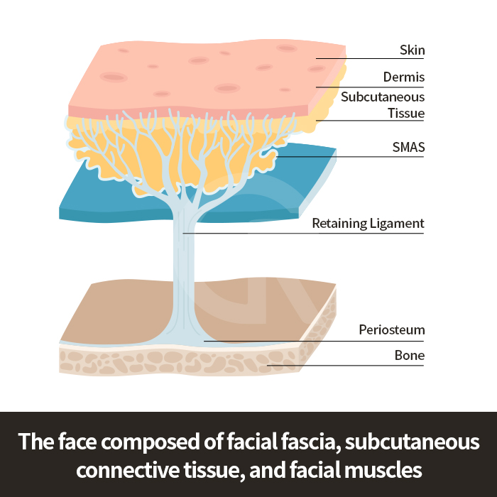 Under-eye hollowing often develops as part of midface descent rather than isolated lower eyelid aging.