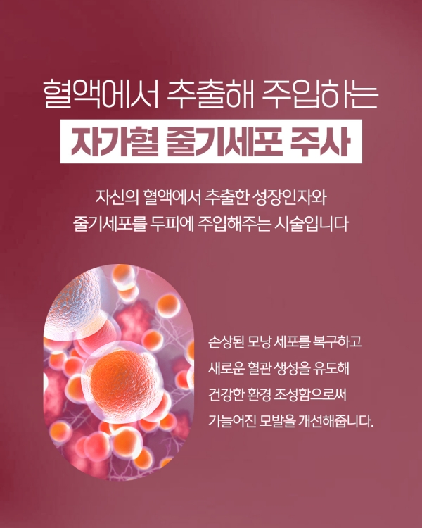 b77a735393014.jpg