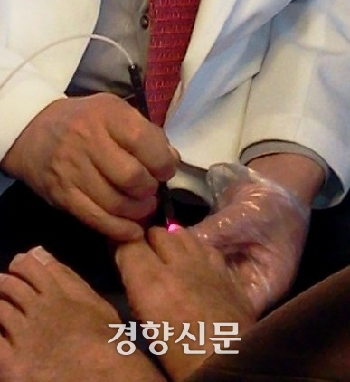 전문의가 레이저로 무좀치료를 하는 모습. 경향DB