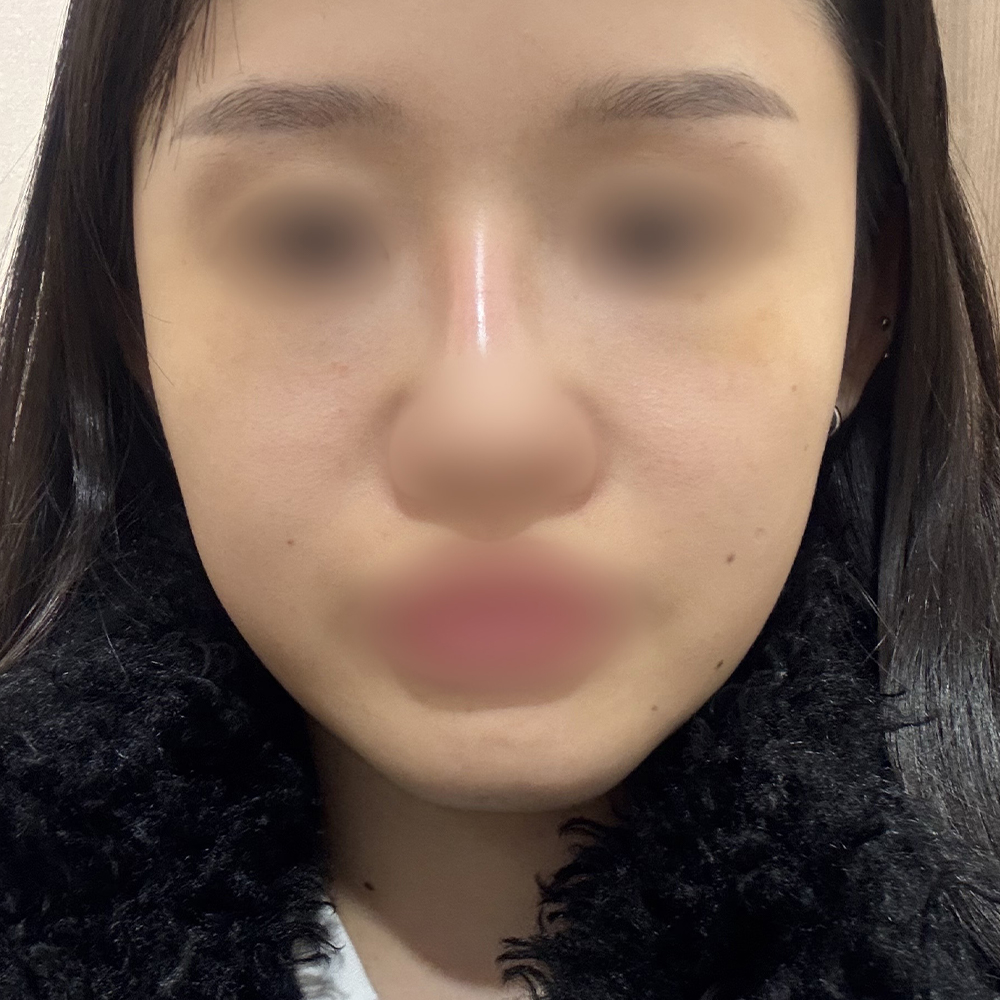7a4ed03e43a62.jpg