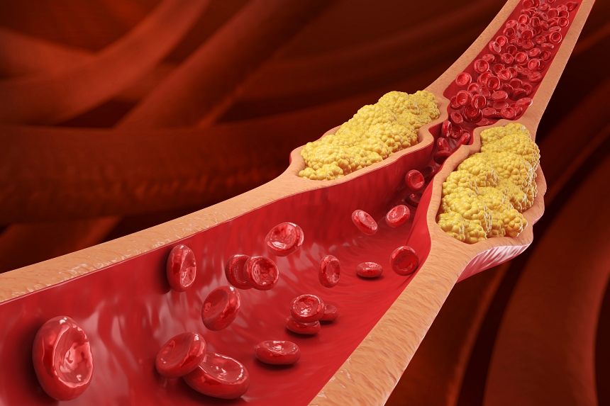 베르베린의 다양한 건강 효능을 설명하는 전문가