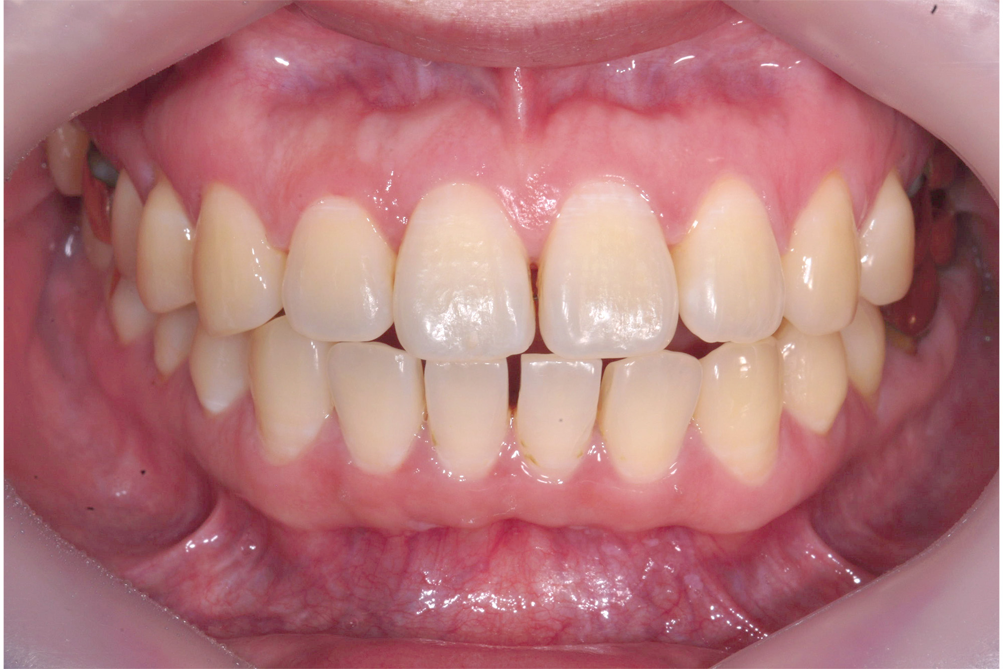 51030b53e4af6.jpg