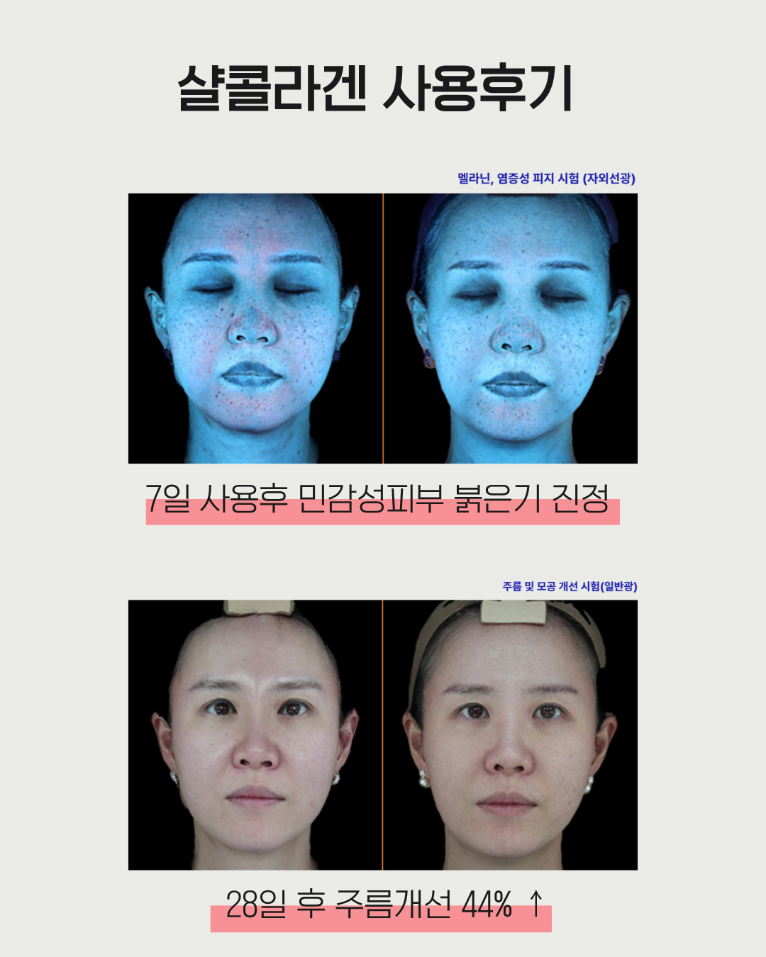 28일 콜라겐복원프로그램