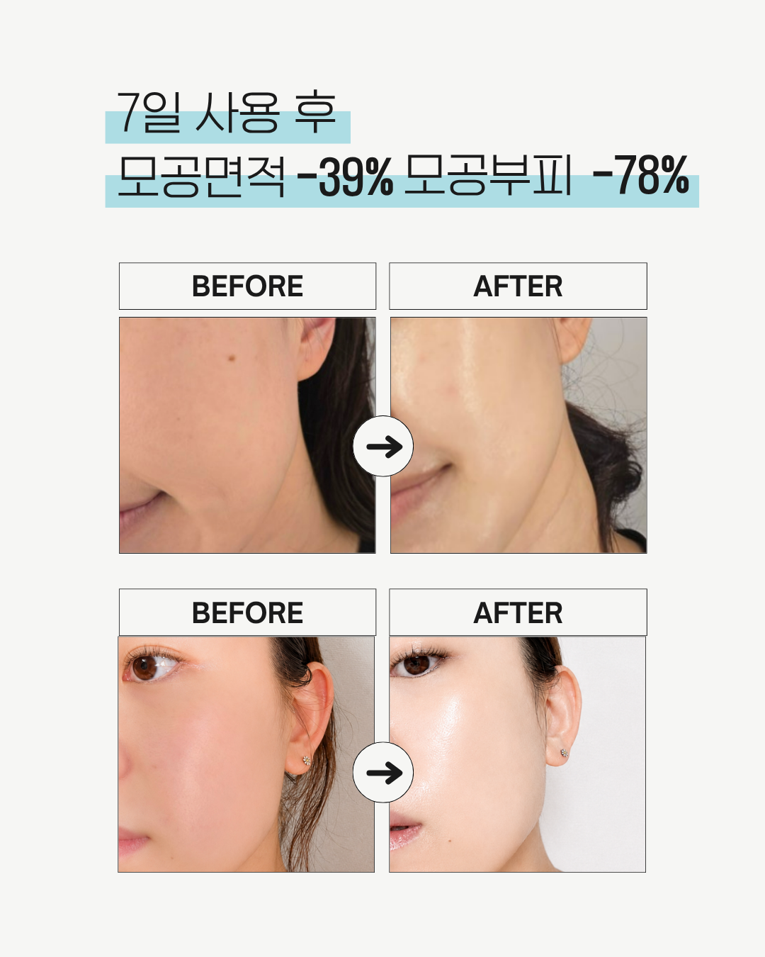28일 콜라겐복원프로그램