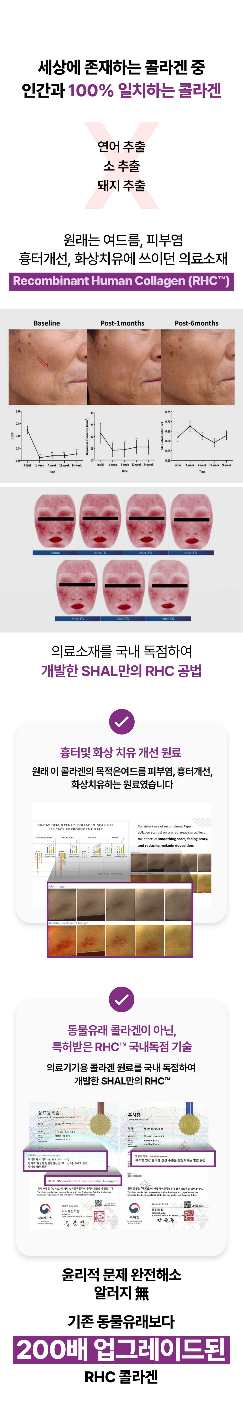 28일 콜라겐복원프로그램
