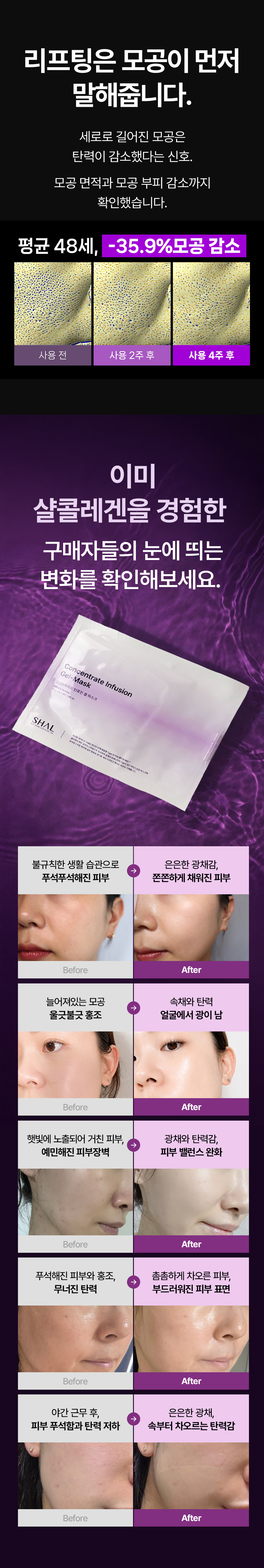 샬 컨센트레이트 인퓨전 겔-마스크