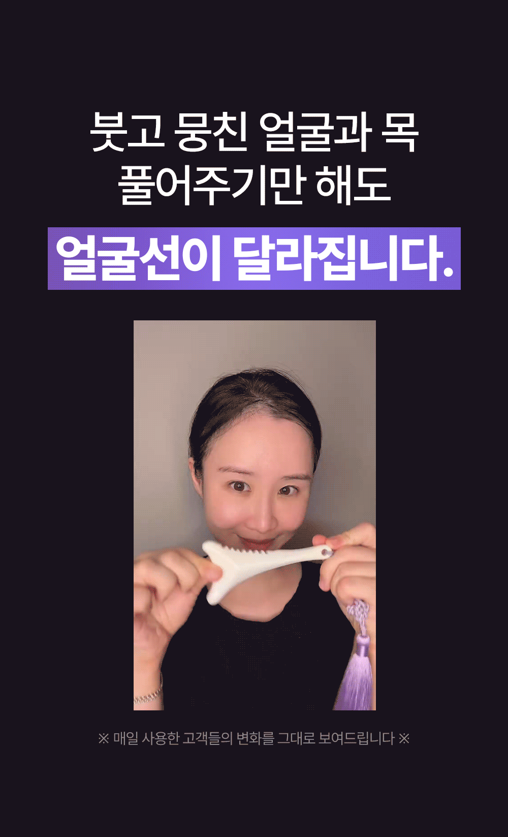 SHAL 도자기괄사