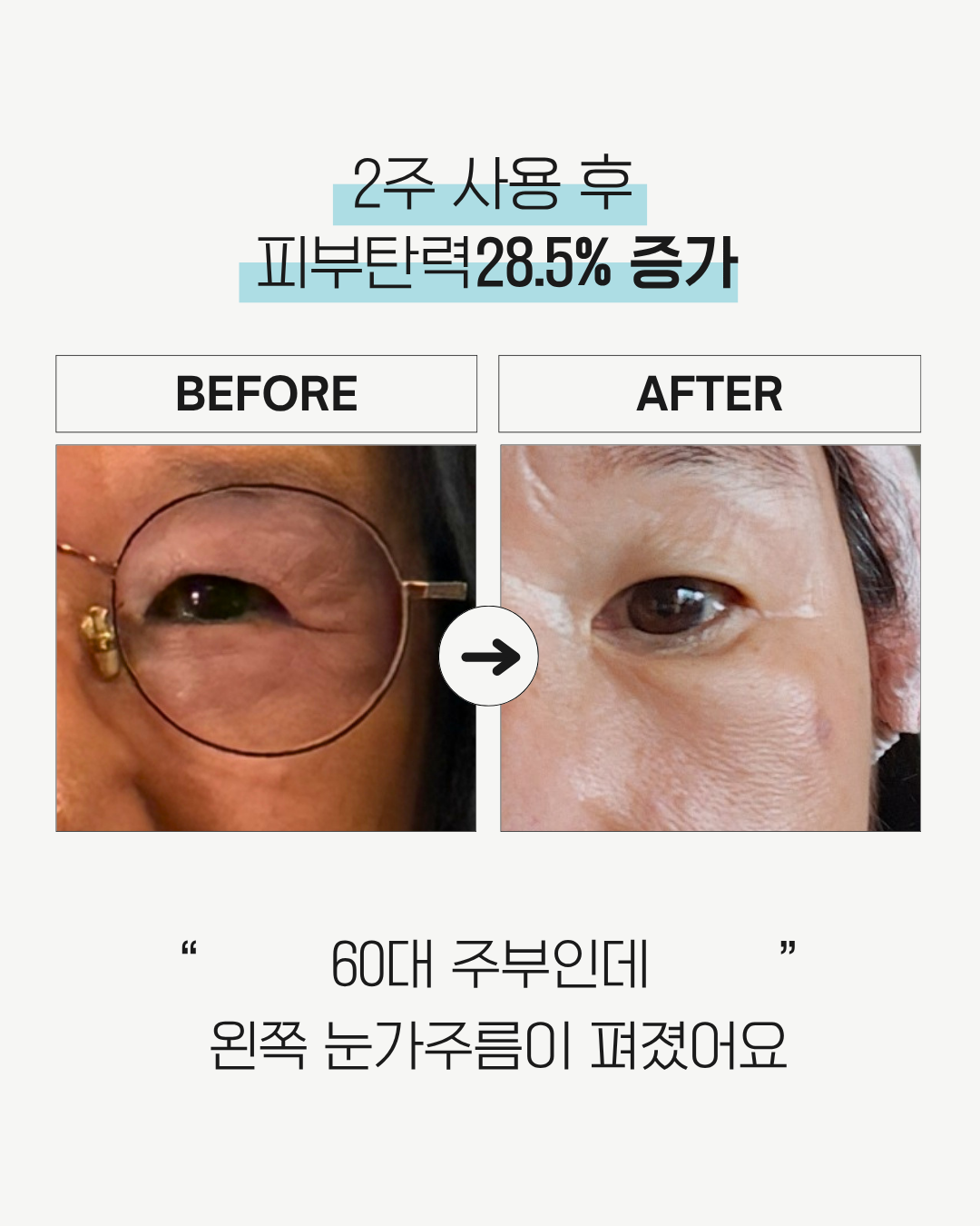28일 콜라겐복원프로그램