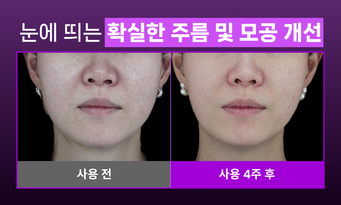 SHAL 광고소재 4 (7).png