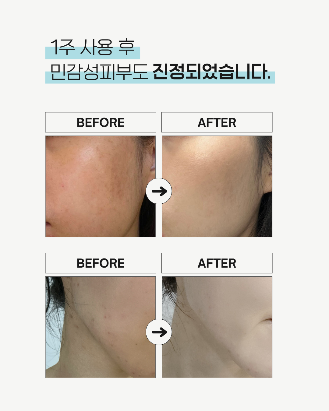 28일 콜라겐복원프로그램