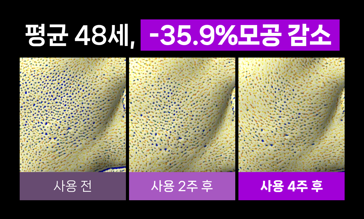 SHAL 광고소재 4 (8).png