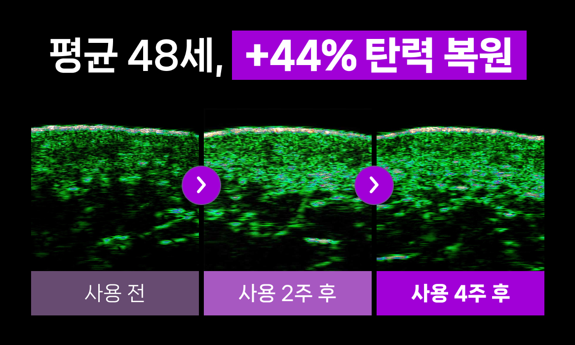 SHAL 광고소재 4 (9).png