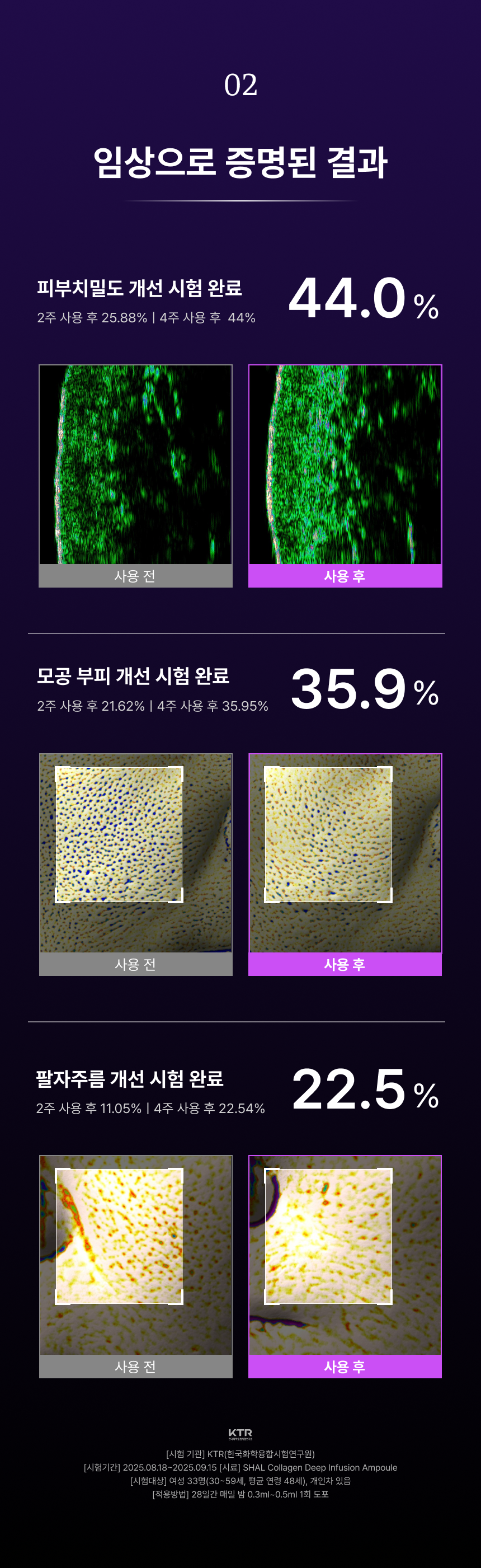 28일 콜라겐 복원 프로그램