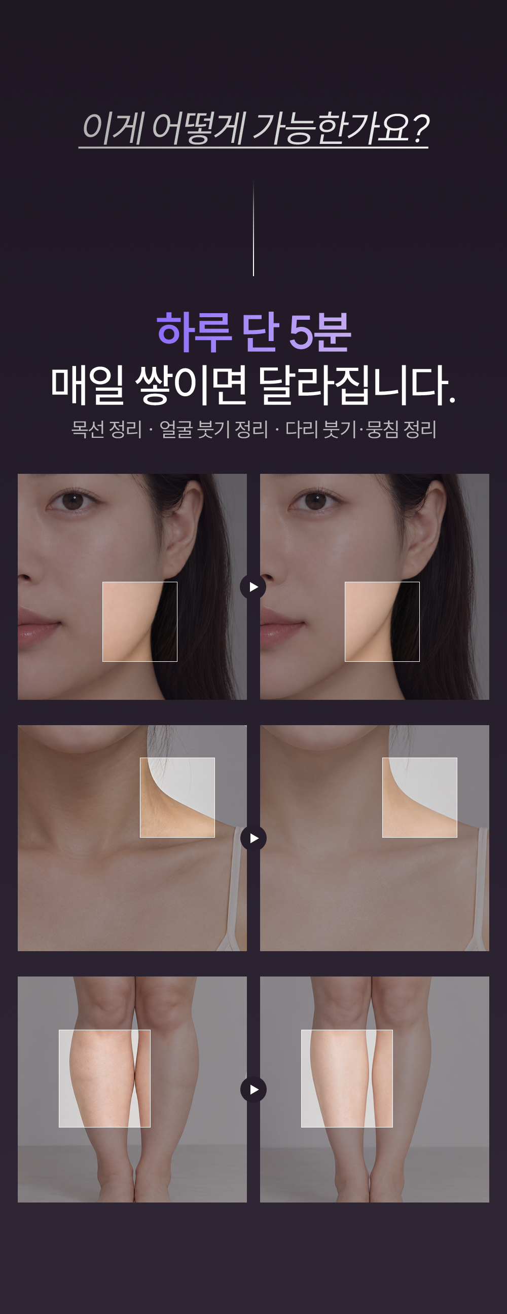 28일 콜라겐복원프로그램