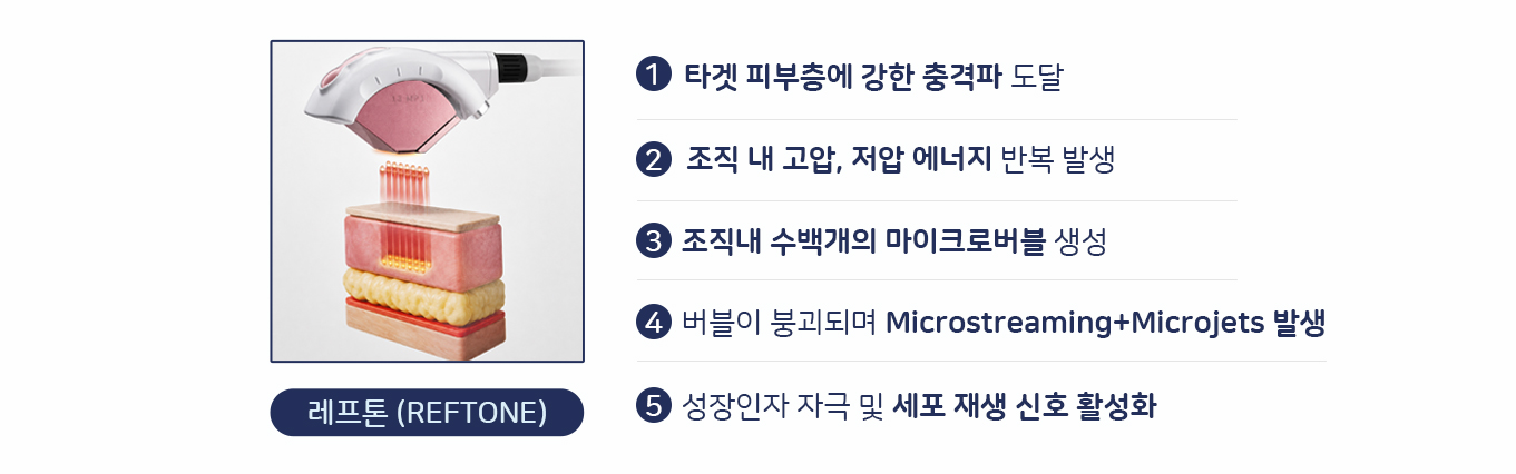 레프톤본문3.jpg
