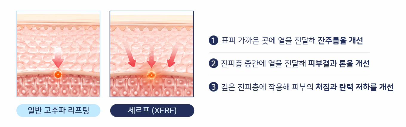 세르프본문3.jpg