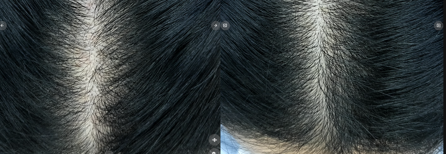 13e7f26e4d054.png